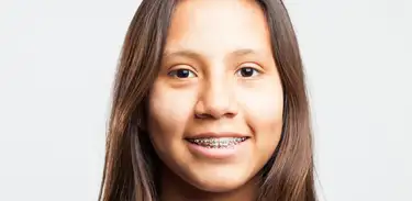 Menina com aparelho dentário