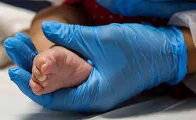 São Paulo (SP), 28/02/2025 - Mês das Doenças Raras. Crianças com doenças raras no hospital Municipal Infantil Menino Jesus. Foto: Paulo Pinto/Agência Brasil