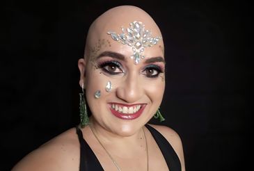 28/09/2023, Matéria Sobre Alopecia areata. Na foto a personagem Lolla Angelucci. Foto: Arquivo Pessoal