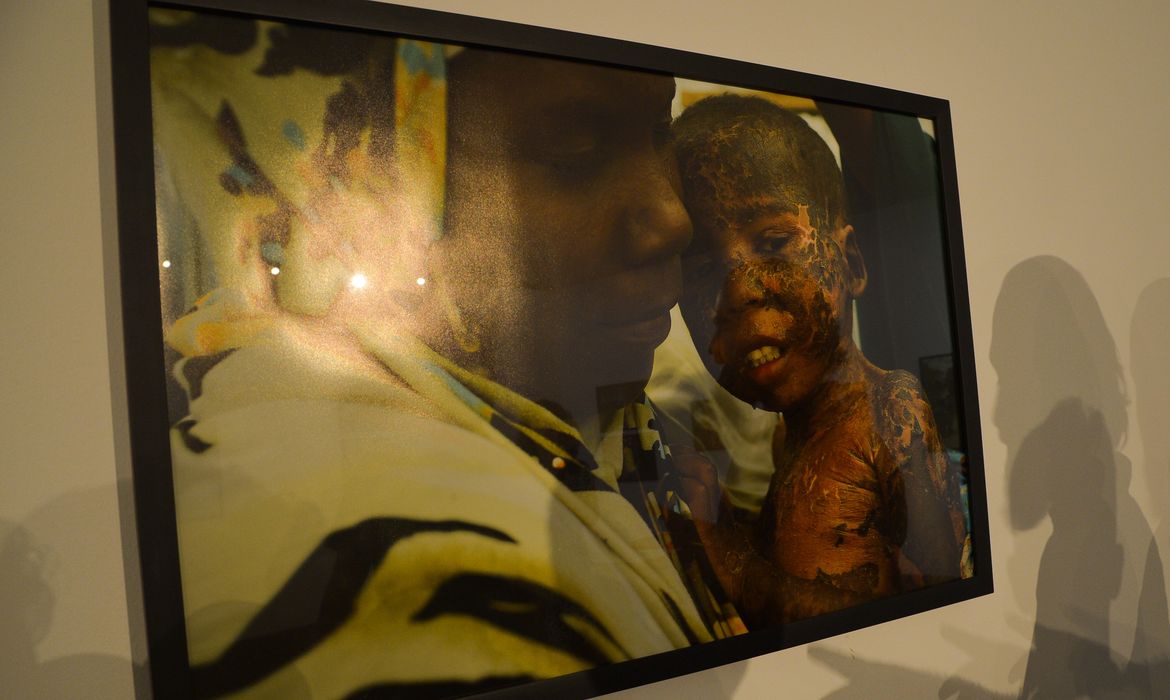 A mostra do fotógrafo André Liohn traz mais de 70 imagens realizadas em hospitais ameaçados e nas linhas de combates entre 2010 e 2013, especialmente na Líbia e Somália (Marcello Casal Jr/Agência Brasil)