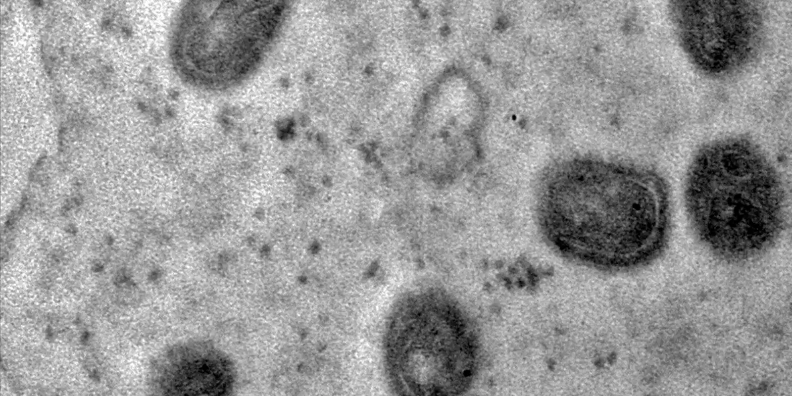 OMS declara fim da emergência em saúde por mpox 1 OMS declara fim da emergência em saúde por mpox