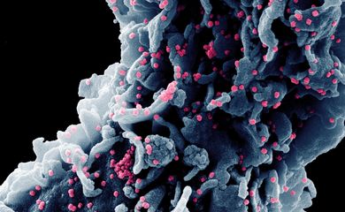 Micrografia eletrônica de varredura colorida de uma célula  infectada com uma cepa variante de partículas do vírus SARS-CoV-2 , isolada de uma amostra de paciente
