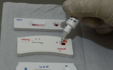São Paulo - O Centro de Referência de Álcool, Tabaco e Outras Drogas (Cratod) oferece teste rápidos e gratuitos para HIV, hepatite B e C e sífilis, em Bom Retiro, na região central da capital paulista (Rovena Rosa/Agência Brasil)