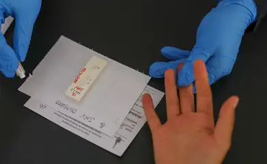 Brasília (DF) 12/12/2025 - Mobilização em Brasília no Dia Mundial de Combate à Aids oferece testagem rápida para HIV, distribuição de autotestes, orientações sobre ISTs e saúde sexual    Foto: Fabio Rodrigues-Pozzebom/ Agência Brasil