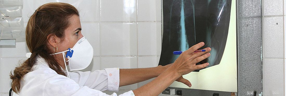Médica analisa exames no Dia Mundial do Combate à Tuberculose
