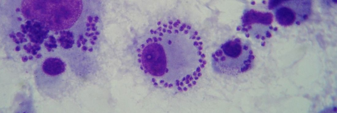 Macrófagos infectados in vitro com Leishmania braziliensis