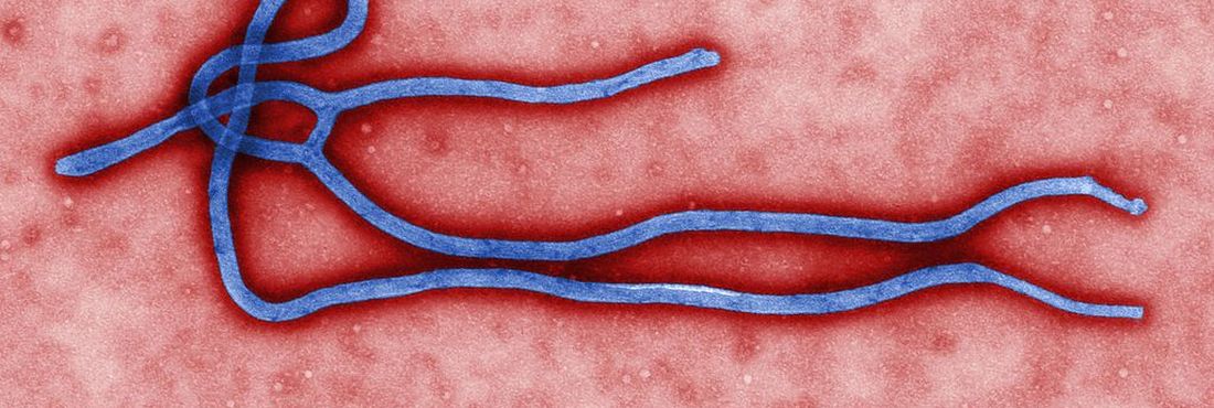 Vírus do ebola