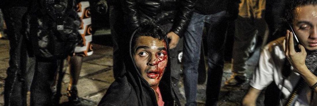 O garoto foi atingido na cabeça durante ato contra o governador Geraldo Alckmin que foi rapidamente reprimido pela Polícia Militar.