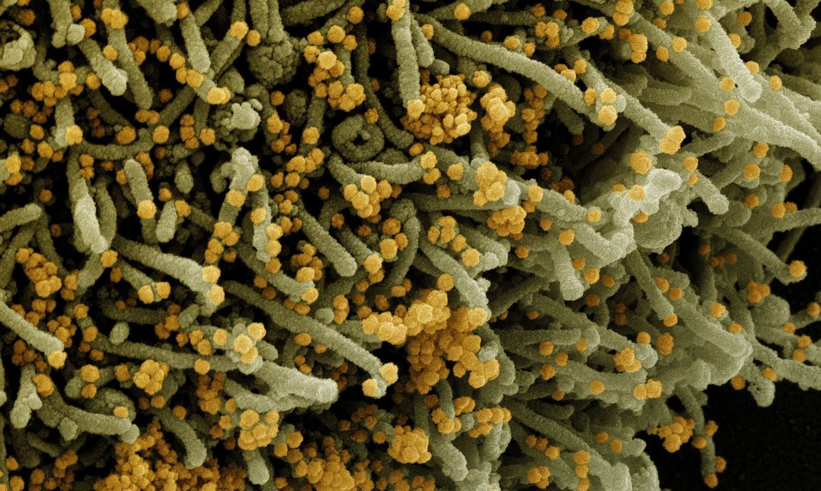 Novo Coronavírus SARS-CoV-2
Micrografia eletrônica de varredura colorida de uma célula infectada com uma cepa variante de partículas do vírus SARS-CoV-2 (laranja), isolada de uma amostra de paciente.