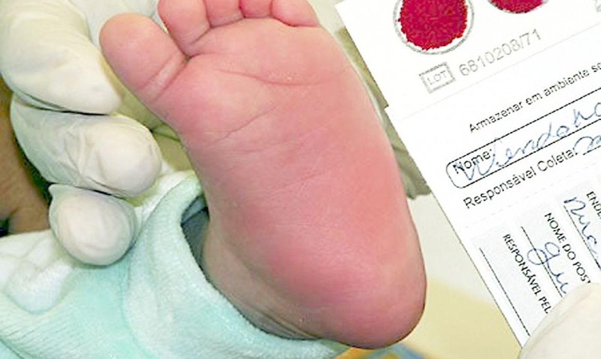 Exame deve ser feito preferencialmente entre o 3º e o 5º dia de vida do bebê.