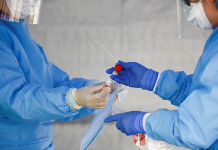 Brazilian Scientists Develop More Accurate Test For Covid 19 Agencia Brasil