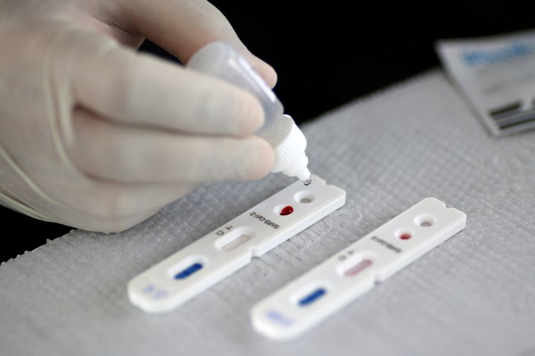 Df Recebe Lote Com 150 Mil Testes Rapidos Para Deteccao De Covid 19 Agencia Brasil Df Recebe Lote Com 150 Mil Testes Rapidos Para Deteccao De Covid 19 Agencia Brasil