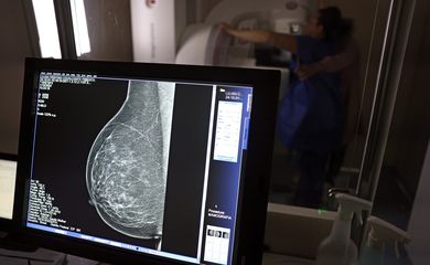 Brasília (DF), 01/10/2024 - Teste de mamografia realizado na Campanha Outubro Rosa: Sesc-DF, que oferece exames e consultas gratuitas às mulheres.  Foto: José Cruz/Agência Brasil