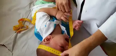 Médica mede com fita métrica a cabeça de um bebê