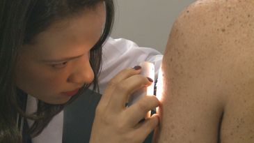 Dermatologista Larissa Pimentel analisa a pele de paciente com xeroderma pigmentoso