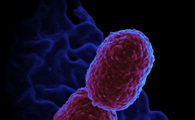 Imagem feita por microscópio eletrônico e colorizada por computador, mostrando a bactéria Klebsiella pneumoniae interagindo com uma célula humana