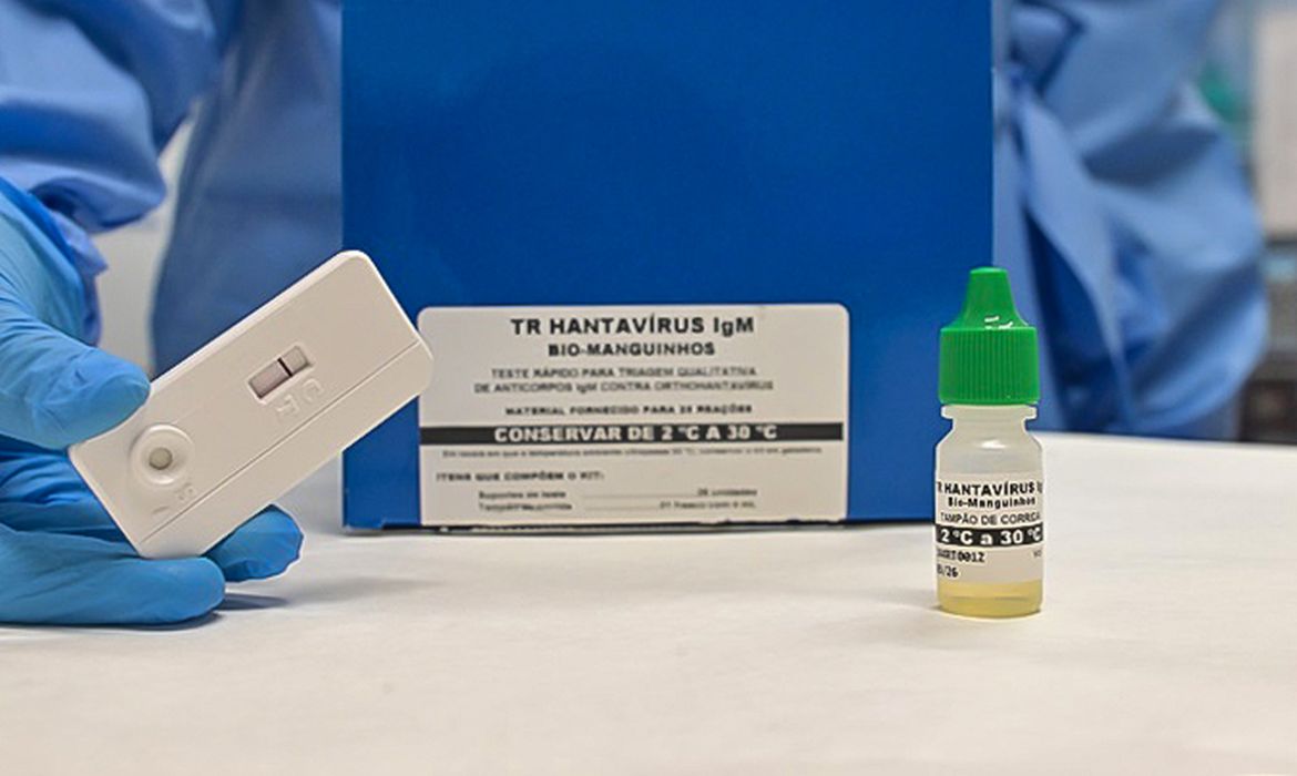 Rudson Amorim Teste rápido para hantavirose: TR Hantavírus IgM Bio-Manguinhos, com destaque para suporte de teste, apresentando resultado negativo, e frasco com solução reagente. Foto: Rudson Amorim, IOC/Fiocruz