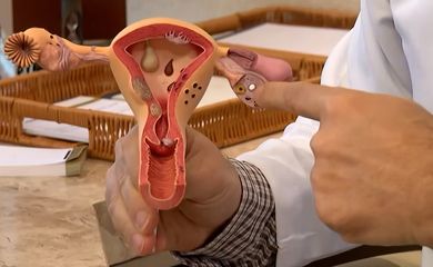 Médica alerta para risco do câncer de ovário e fala sobre cuidados