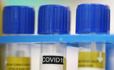 .Ministério da Saúde vai mudar protocolo e aumentar testagem para coronavírus