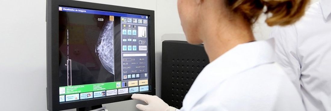 Profissional de saúde analisa exame de mamografia