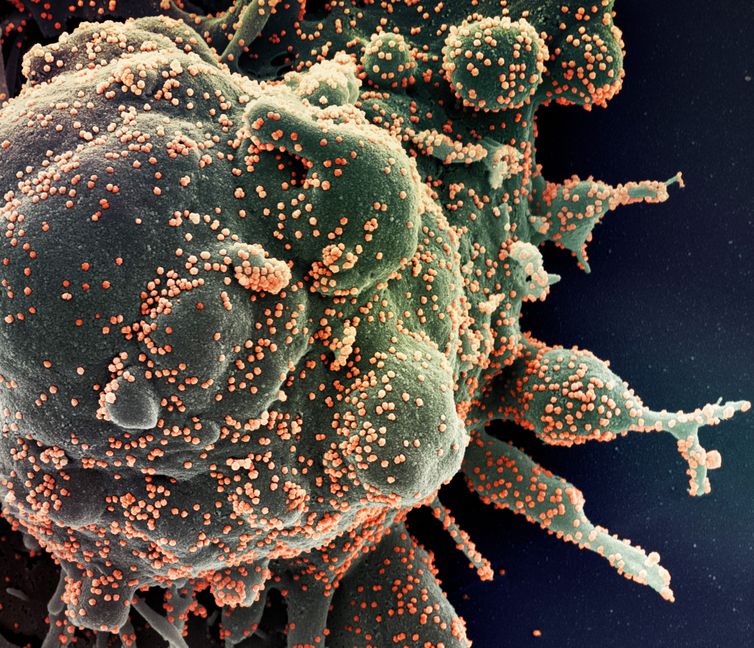 New Omicron subvariants detected in Rio by university's sequencing - Vimarsana News