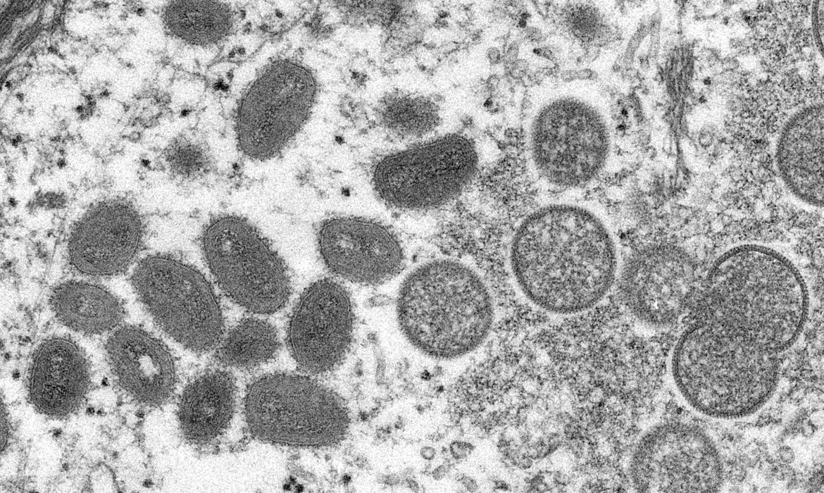 FILE PHOTO: CDC microscopic image shows monkeypox virus particles