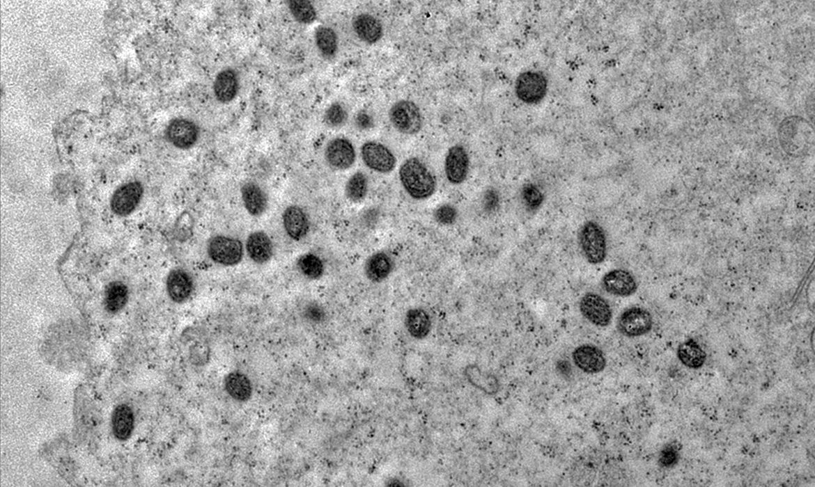 02_A varíola dos macacos é transmitida pelo vírus monkeypox, que pertence ao gênero orthopoxvirus