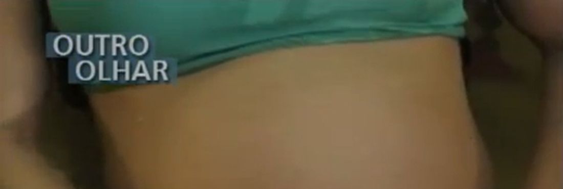 Parto humanizado Parto humanizado