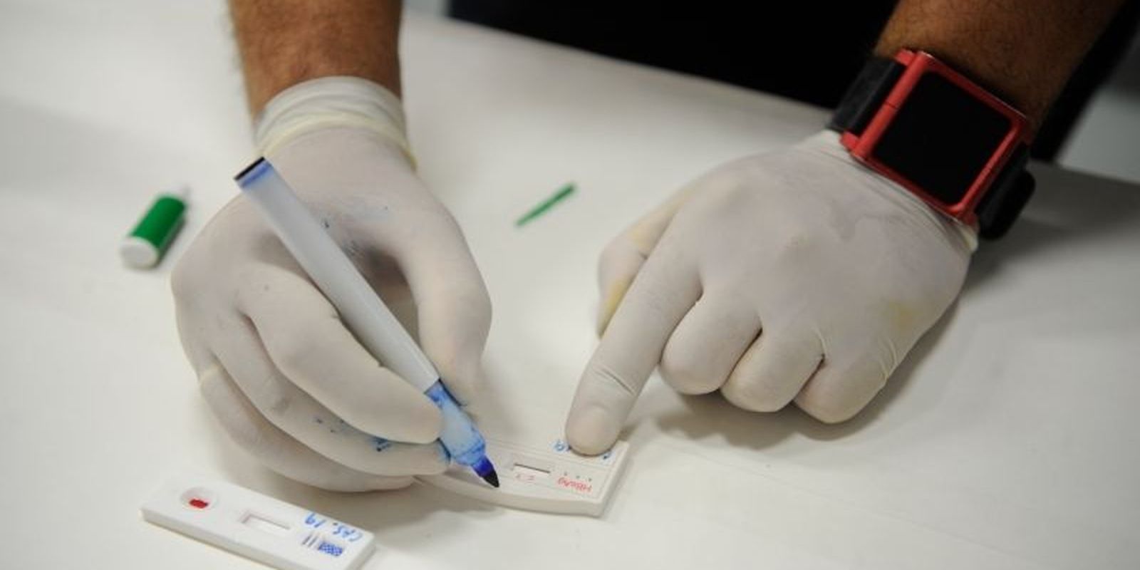 Hepatite B terá notificação compulsória para gestantes Hepatite B terá notificação compulsória para gestantes