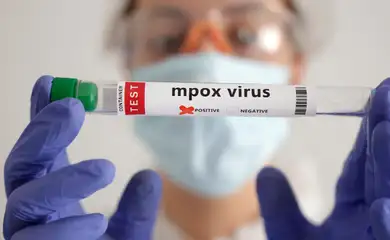 A test tube labelled