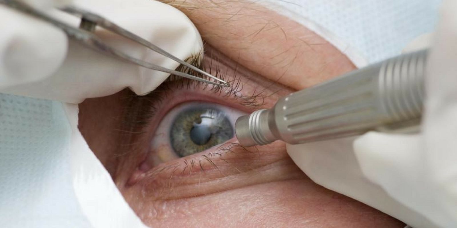 Abril Marrom alerta sobre doenças que podem levar à cegueira