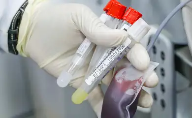 Brasília (DF), 30/09/2024 - Tubos de coleta de sangue para a matéria de Teste rápido na detecção da febre bubônica. Foto: Lúcio Bernardo Jr/Agência Brasília